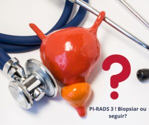 PI-RADS 3 na Ressonância de Próstata? Biopsiar ou seguir?