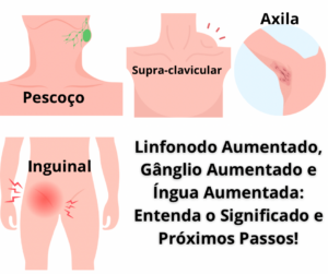 Linfonodo aumentado, Gânglio Aumentado, íngua Aumentada, Lindonodomegalia no pescoço, região supra-clavicular, região inguinal.axila e